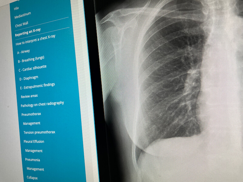 example of radiology teaching content