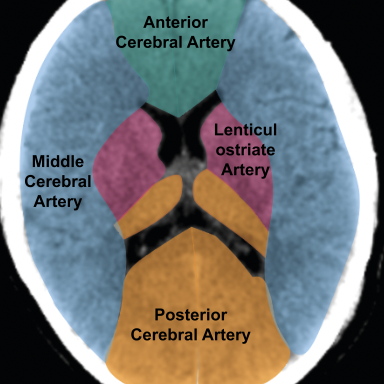 anotated ct scan